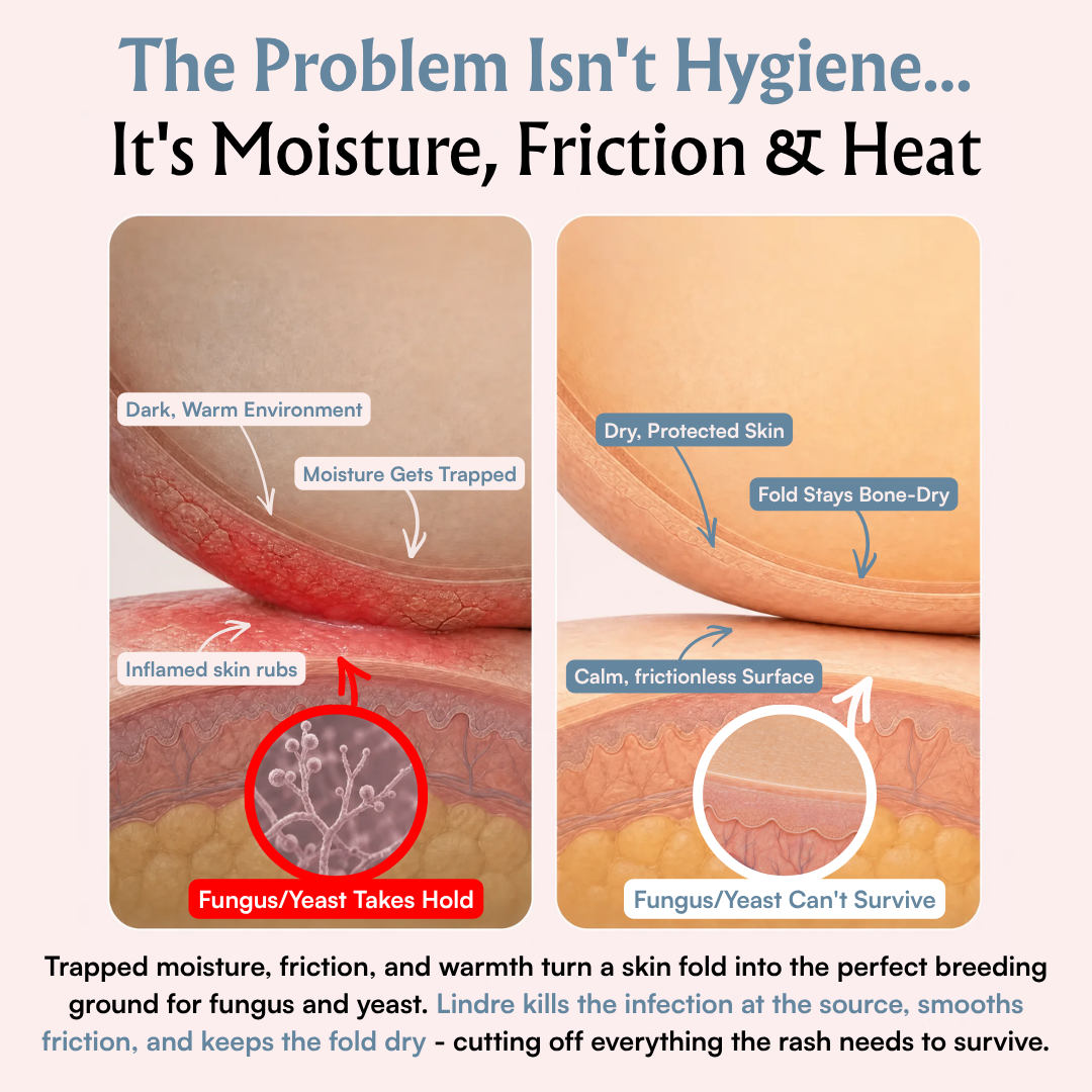 Lindre Organics™ Anti-Fungal Balm for Intertrigo & Skin Fold Irritation