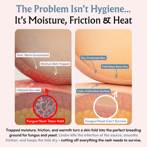 Lindre Organics™ Anti-Fungal Balm for Intertrigo & Skin Fold Irritation